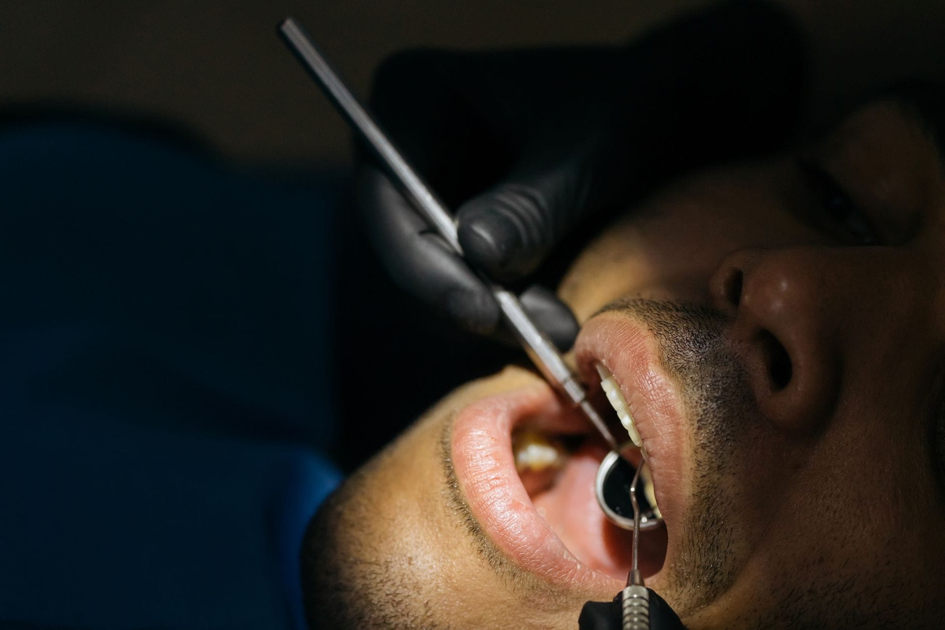 May Wear Down Your Tooth Enamel