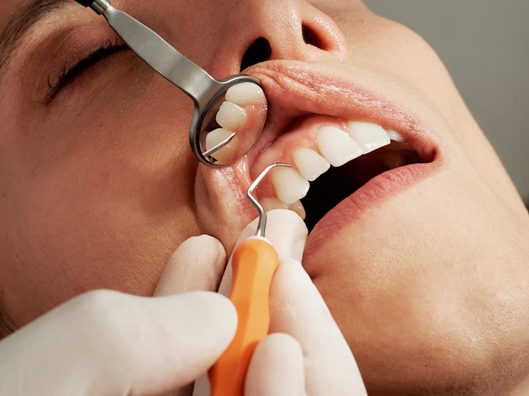 Your Teeth Feel It First