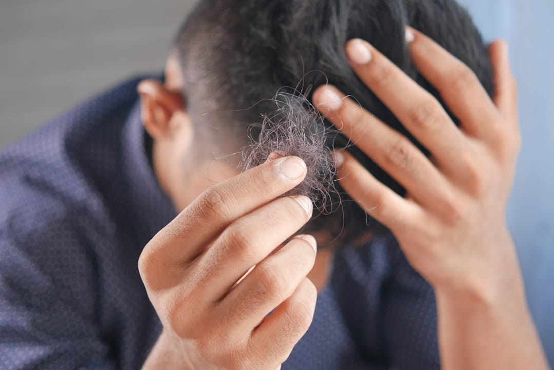 11 Home Remedies That Actually Help With Hair Fall (and What Causes It in the First Place)