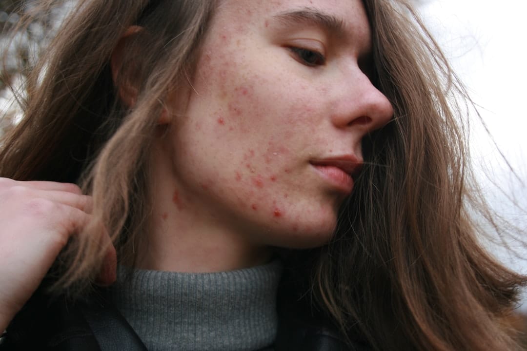 How to Calm a Face Rash With Things Already Sitting in Your Kitchen