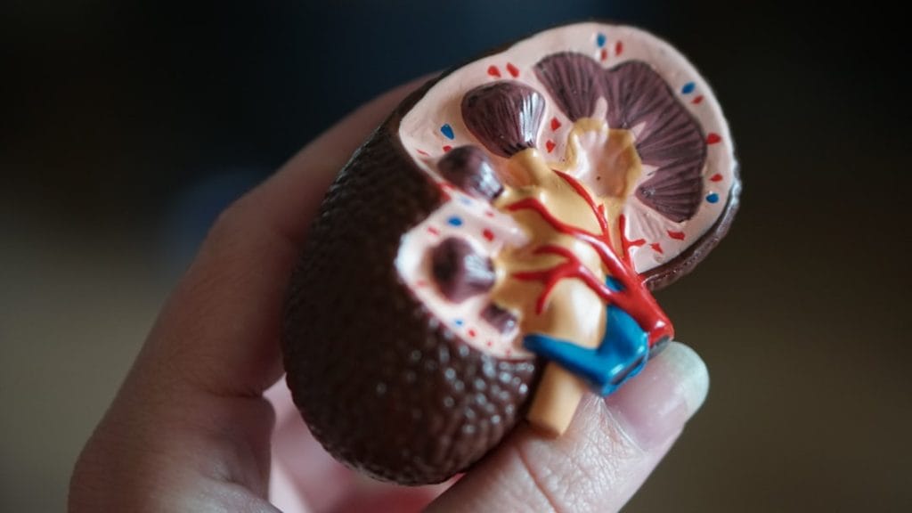 Kidney Stone Diet: Foods to Eat and Avoid